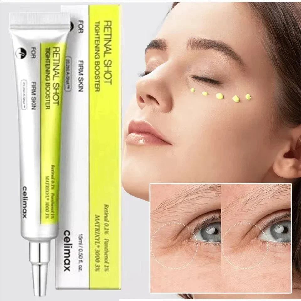 Celimax Vitamin A Eye Balm – Anti-Aging Eye Cream for Dark Circles, Puffy Eyes & Fine Lines | Korean Skincare